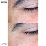 Camaleon ULTRA PLUS Hyaluronic Acid Serum 15ml - Image 2