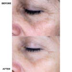 Camaleon ULTRA PLUS Vitamin C Serum 15ml - Image 2